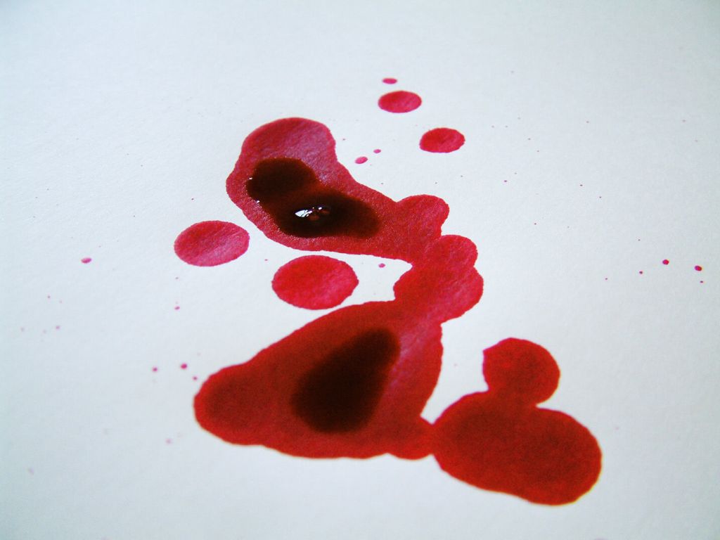 Почему люди теряют сознание при виде крови